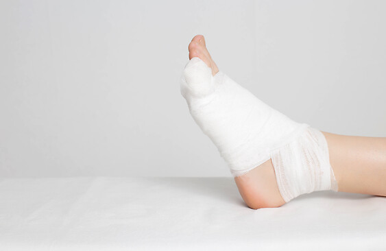 Zdjęcie ilustracyjne - stopa w bandażu