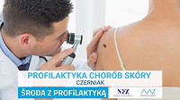 Grafika Środa z Profilaktyka. Profilaktyka nowotworów skóry. Na zdjęciu badanie znamienia na plecach za pomocą lupy