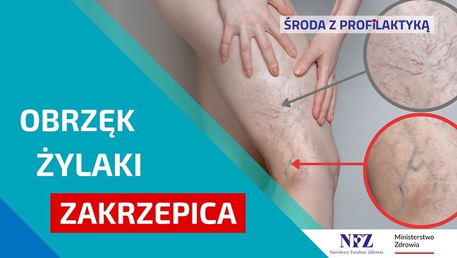 Grafika Środa z Profilaktyką. Obrzęki, żylaki, zakrzepica